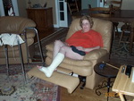 Gloria Broken Foot